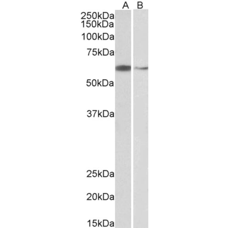 Western Blot - Anti-ARIH2/TRIAD1 Antibody (A83903) - Antibodies.com