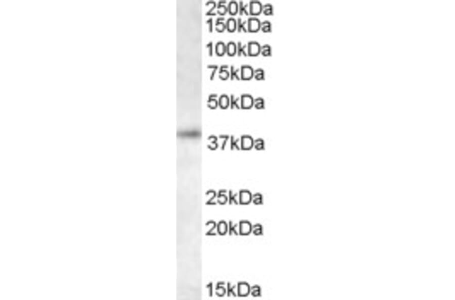 Western Blot - Anti-RING2/RING1B/RNF2 Antibody (A83904) - Antibodies.com