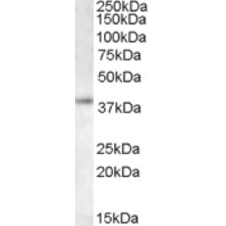 Western Blot - Anti-RING2/RING1B/RNF2 Antibody (A83904) - Antibodies.com