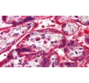 Immunohistochemistry - Anti-NEIL1 Antibody (A83905) - Antibodies.com