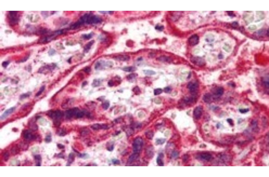 Immunohistochemistry - Anti-NEIL1 Antibody (A83905) - Antibodies.com