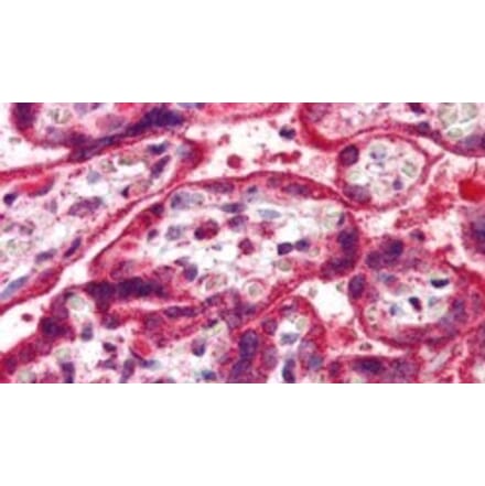 Immunohistochemistry - Anti-NEIL1 Antibody (A83905) - Antibodies.com