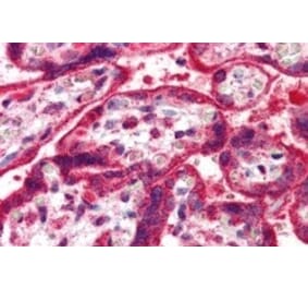 Immunohistochemistry - Anti-NEIL1 Antibody (A83905) - Antibodies.com