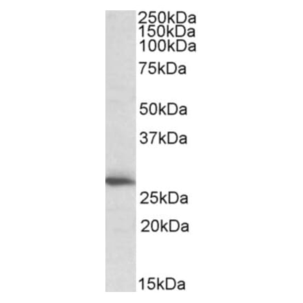 Western Blot - Anti-CLPP Antibody (A83906) - Antibodies.com