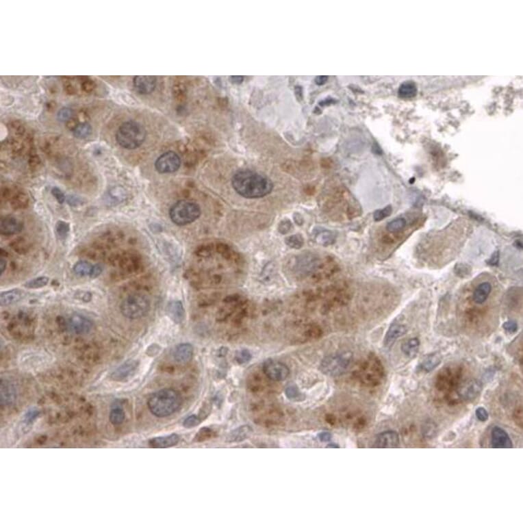 Immunohistochemistry - Anti-CLPP Antibody (A83906) - Antibodies.com