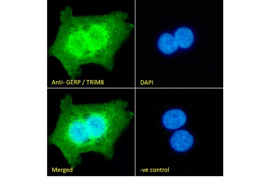 Immunofluorescence - Anti-TRIM8 Antibody (A83907) - Antibodies.com