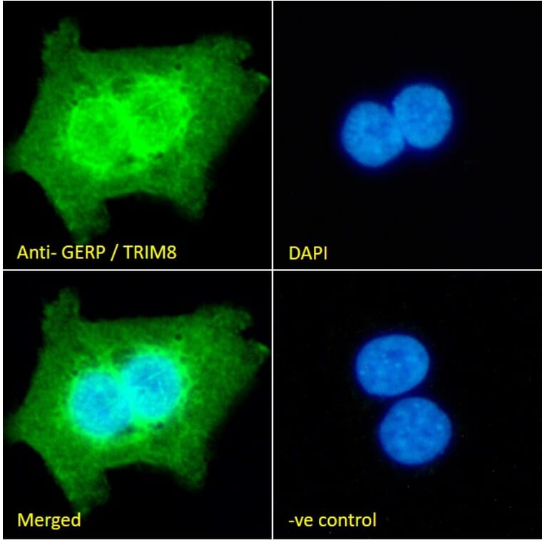 Immunofluorescence - Anti-TRIM8 Antibody (A83907) - Antibodies.com