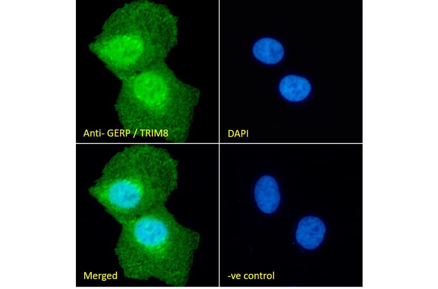Immunofluorescence - Anti-TRIM8 Antibody (A83907) - Antibodies.com
