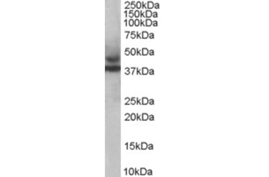 Western Blot - Anti-TRIM54 Antibody (A83909) - Antibodies.com