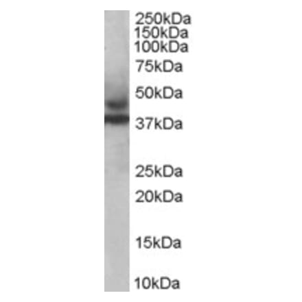 Western Blot - Anti-TRIM54 Antibody (A83909) - Antibodies.com