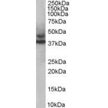 Western Blot - Anti-TRIM54 Antibody (A83909) - Antibodies.com