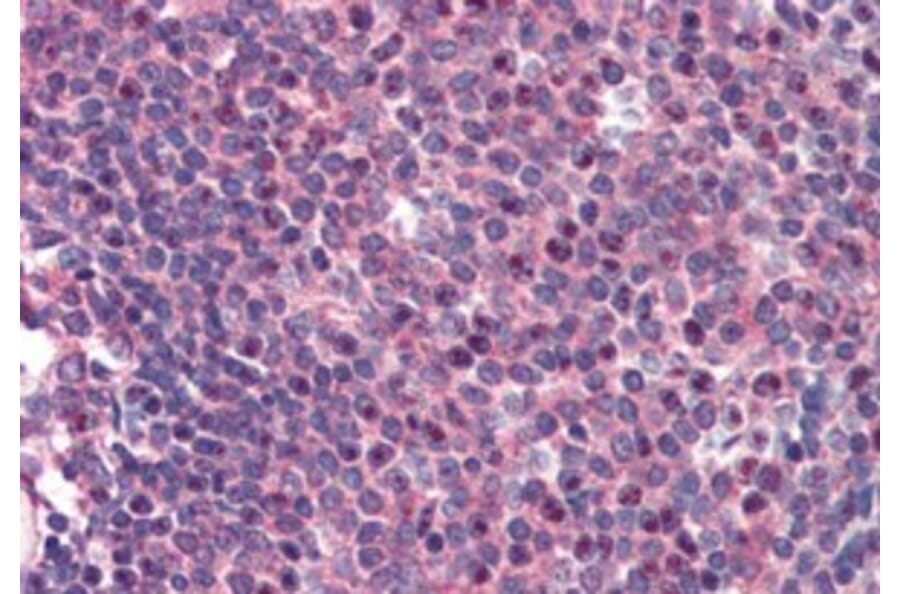 Immunohistochemistry - Anti-Carma 1/CARD11 Antibody (A83910) - Antibodies.com