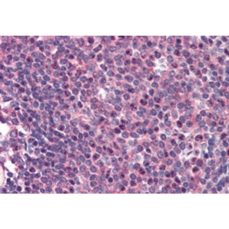 Immunohistochemistry - Anti-Carma 1/CARD11 Antibody (A83910) - Antibodies.com
