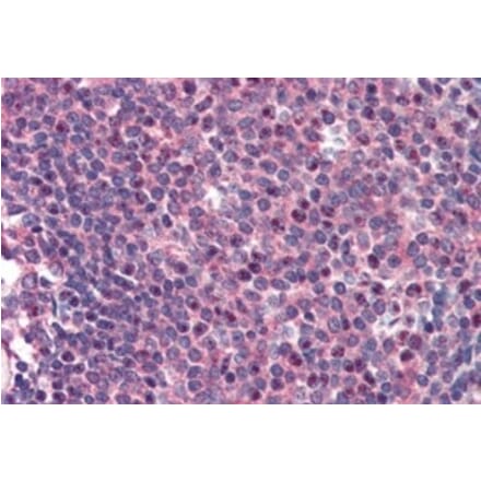 Immunohistochemistry - Anti-CARD11 Antibody (A83910) - Antibodies.com