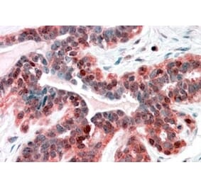Immunohistochemistry - Anti-SNX12 Antibody (A83912) - Antibodies.com