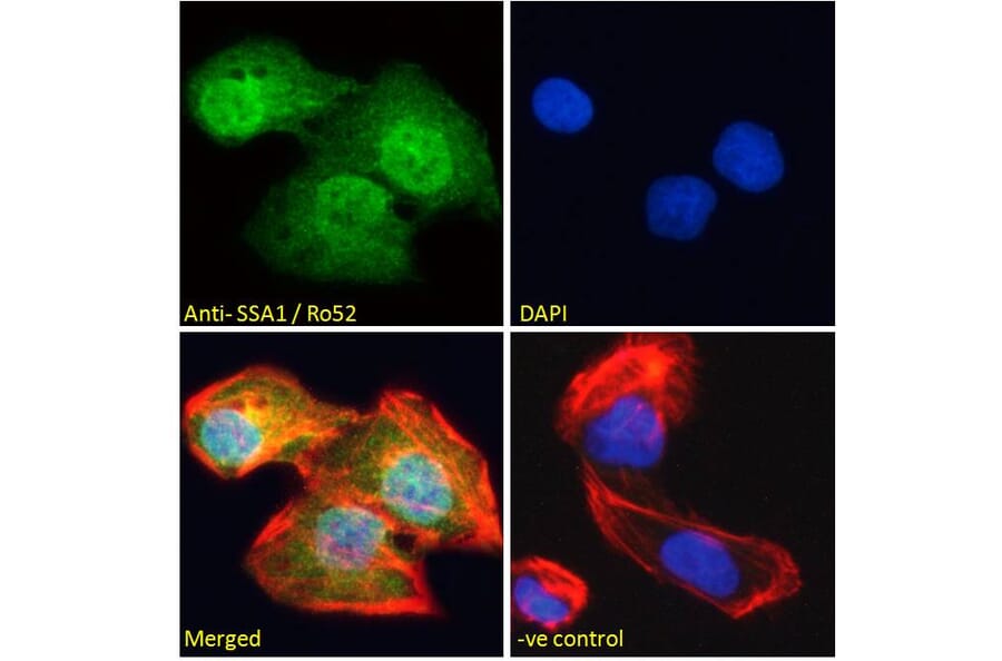 Immunofluorescence - Anti-TRIM21 Antibody (A83914) - Antibodies.com