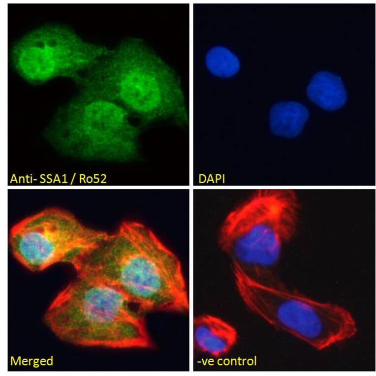 Immunofluorescence - Anti-TRIM21 Antibody (A83914) - Antibodies.com