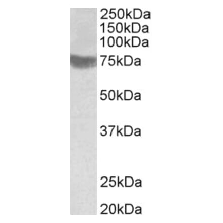 Western Blot - Anti-TRC8 Antibody (A83915) - Antibodies.com