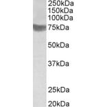 Western Blot - Anti-TRC8 Antibody (A83915) - Antibodies.com