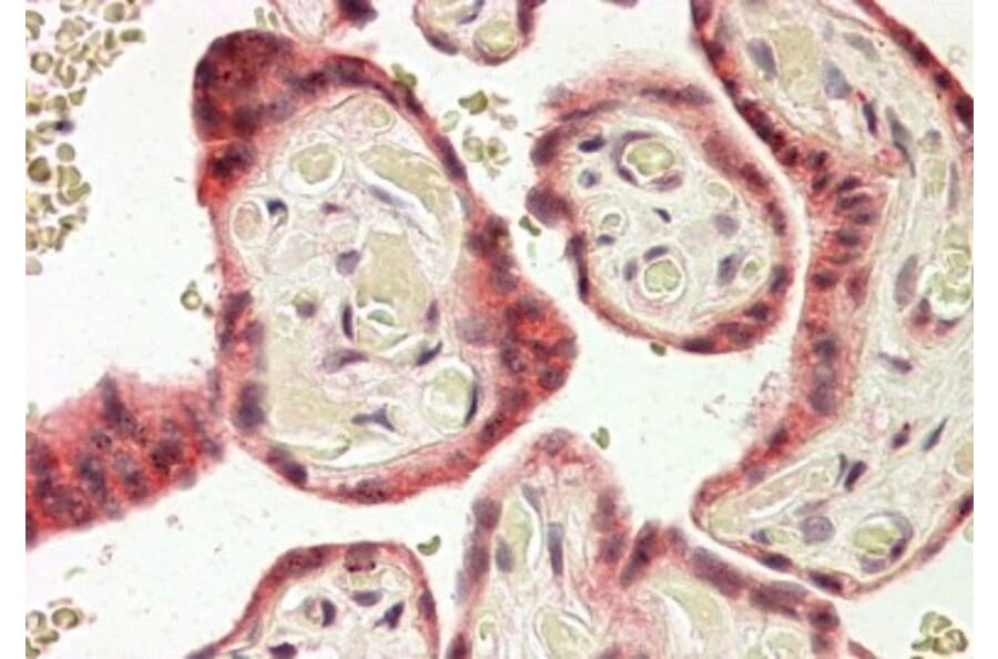 Immunohistochemistry - Anti-TRC8 Antibody (A83915) - Antibodies.com
