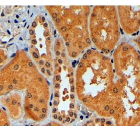 Immunohistochemistry - Anti-TRIM11 Antibody (A83916) - Antibodies.com