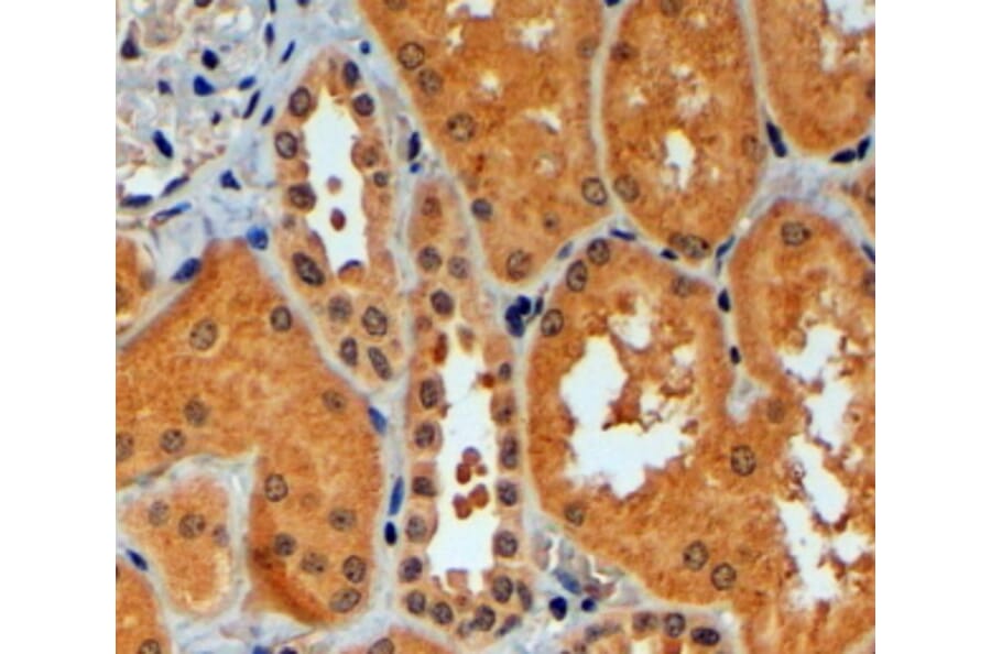 Immunohistochemistry - Anti-TRIM11 Antibody (A83916) - Antibodies.com
