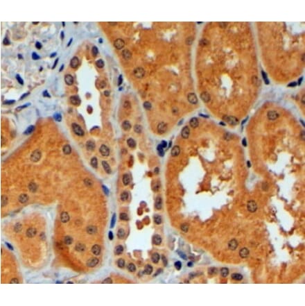 Immunohistochemistry - Anti-TRIM11 Antibody (A83916) - Antibodies.com