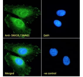 Immunofluorescence - Anti-SNX18 Antibody (A83917) - Antibodies.com
