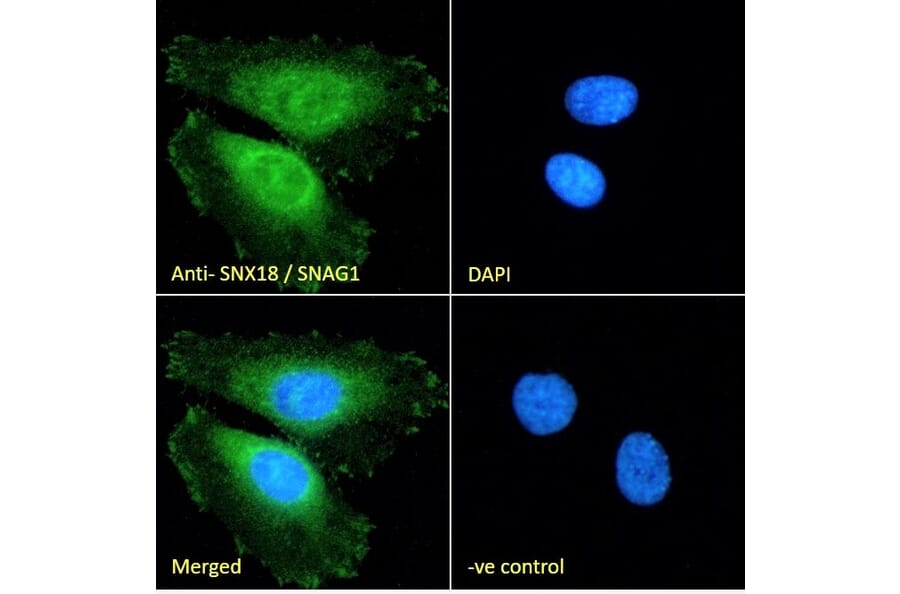 Immunofluorescence - Anti-SNX18 Antibody (A83917) - Antibodies.com