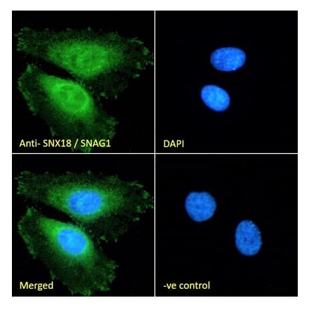 Immunofluorescence - Anti-SNX18 Antibody (A83917) - Antibodies.com