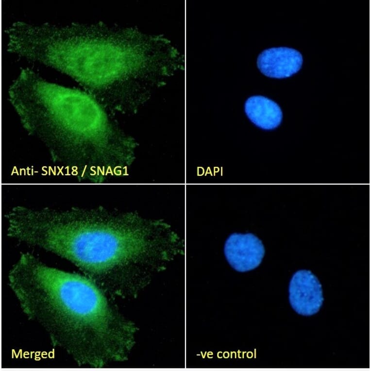 Immunofluorescence - Anti-SNX18 Antibody (A83917) - Antibodies.com