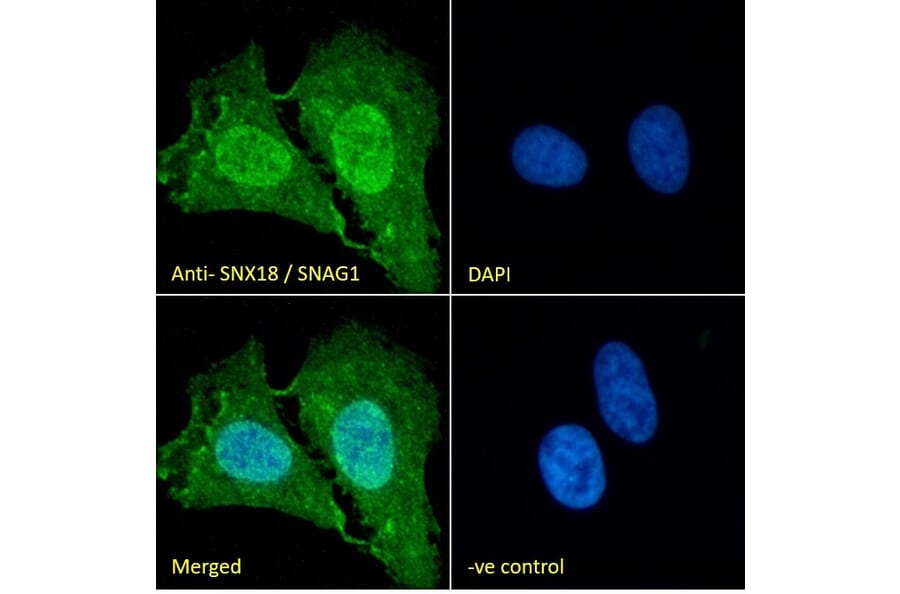 Immunofluorescence - Anti-SNX18 Antibody (A83917) - Antibodies.com