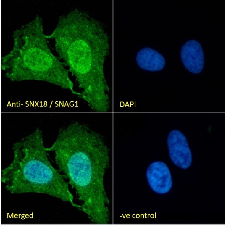 Immunofluorescence - Anti-SNX18 Antibody (A83917) - Antibodies.com