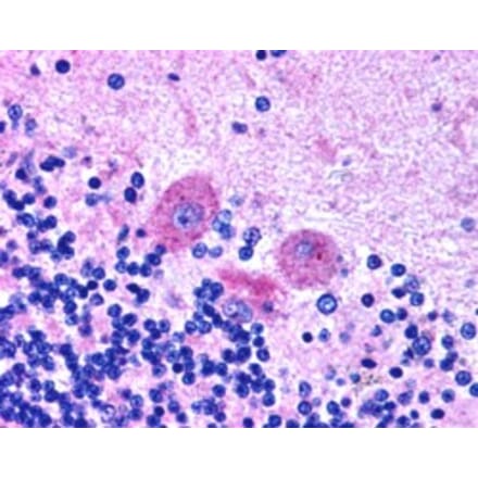 Immunohistochemistry - Anti-SNX26 Antibody (A83918) - Antibodies.com