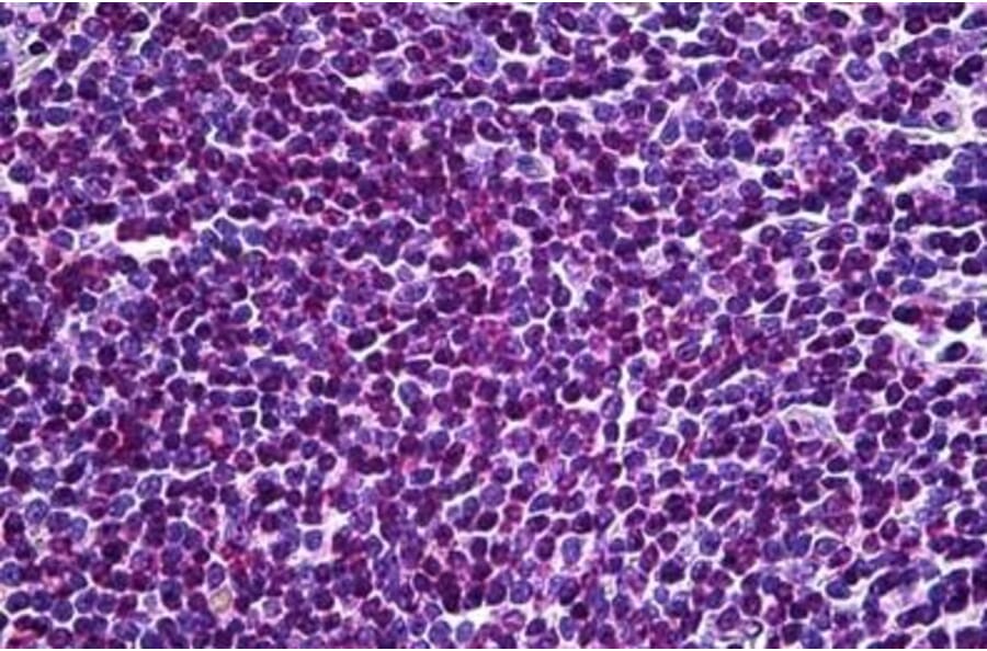 Immunohistochemistry - Anti-EDD Antibody (A83919) - Antibodies.com