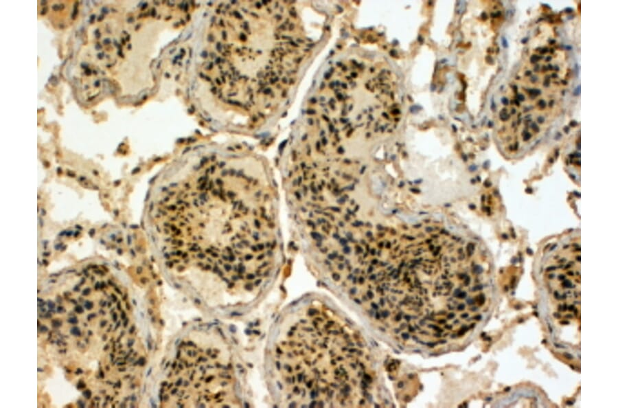 Immunohistochemistry - Anti-EDD Antibody (A83919) - Antibodies.com