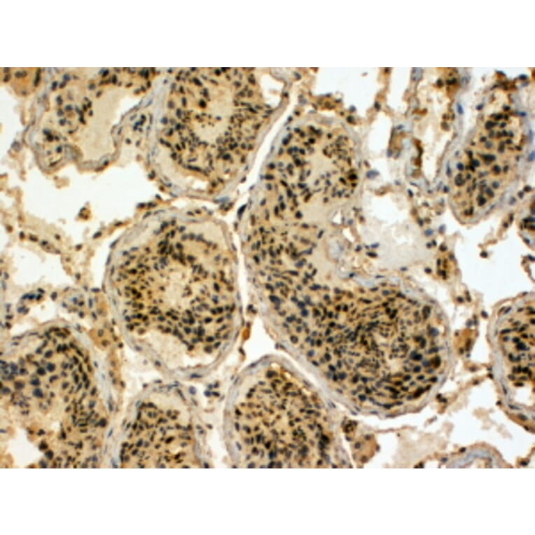 Immunohistochemistry - Anti-EDD Antibody (A83919) - Antibodies.com