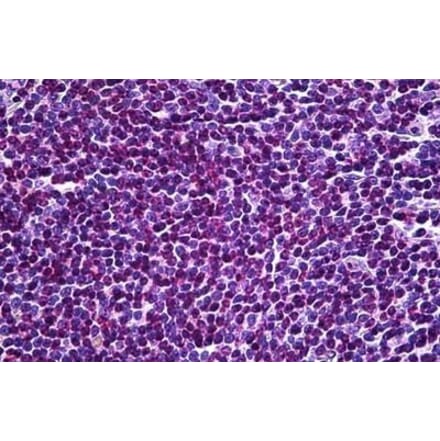 Immunohistochemistry - Anti-UBR5 Antibody (A83919) - Antibodies.com