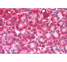 Immunohistochemistry - Anti-CARD6 Antibody (A83920) - Antibodies.com