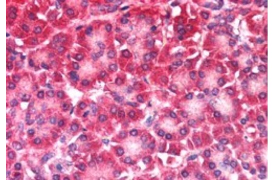 Immunohistochemistry - Anti-CARD6 Antibody (A83920) - Antibodies.com