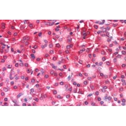 Immunohistochemistry - Anti-CARD6 Antibody (A83920) - Antibodies.com