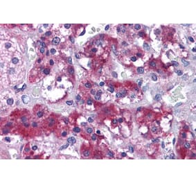 Immunohistochemistry - Anti-MERTK Antibody (A83923) - Antibodies.com