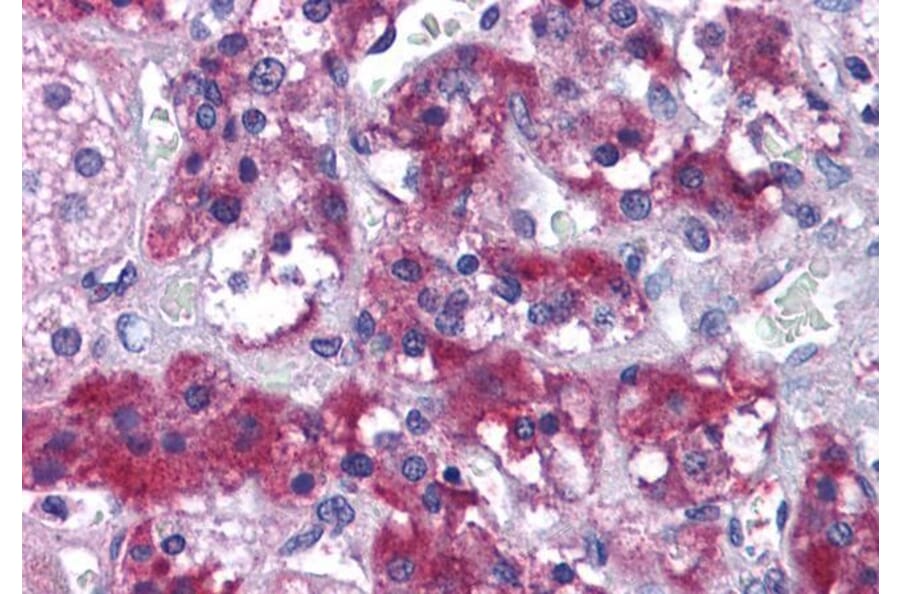 Immunohistochemistry - Anti-MERTK Antibody (A83923) - Antibodies.com