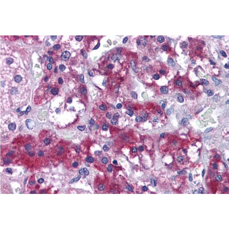 Immunohistochemistry - Anti-MERTK Antibody (A83923) - Antibodies.com