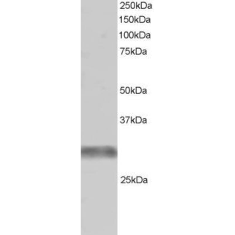 Western Blot - Anti-TRIM7 Antibody (A83925) - Antibodies.com