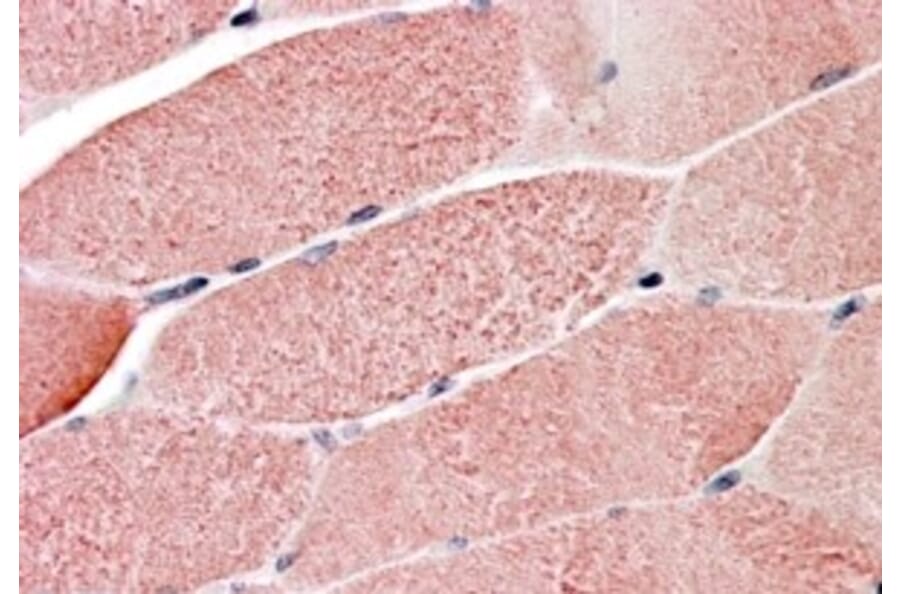 Immunohistochemistry - Anti-TRIM7 Antibody (A83925) - Antibodies.com