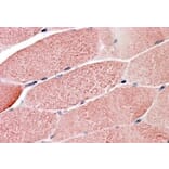 Immunohistochemistry - Anti-TRIM7 Antibody (A83925) - Antibodies.com