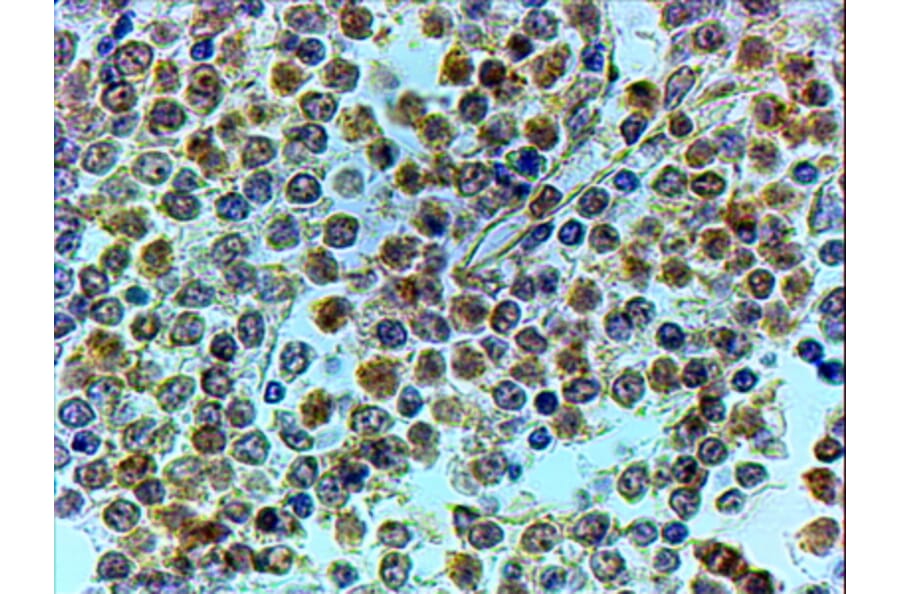 Immunohistochemistry - Anti-TRIP Antibody (A83926) - Antibodies.com