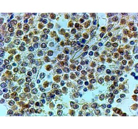 Immunohistochemistry - Anti-TRAIP Antibody (A83926) - Antibodies.com