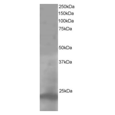 Western Blot - Anti-Pallidin Antibody (A83927) - Antibodies.com